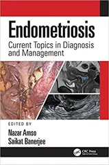 Endometriosis Current Topics in Diagnosis and Management 1st Edition 2022 by Nazar Amso