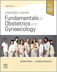 Llewellyn Jones Fundamentals Of Obstetrics And Gynaecology With Access Code 11th Edition 2023 By Oats JJN
