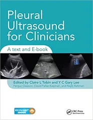 Pleural Ultrasound for Clinicians A Text and E-book 1st Edition 2020 by Claire Tobin