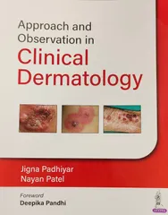 Approach and Observation in Clinical Dermatology 1st Edition 2023 By Jigna Padhiyar, Nayan Patel