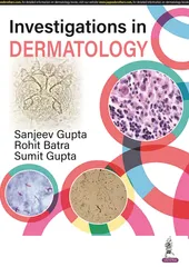 Investigations in Dermatology 1st Edition 2023 by Sanjeev Gupta