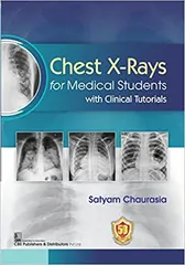 Chest X Rays For Medical Students With Clinical Tutorials 2023 By Chaurasia S
