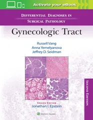 Differential Diagnoses In Surgical Pathology Gynecologic Tract With Access Code 2nd Edition 2024 By Vang R