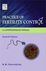 Practice of Fertility Control A Comprehensive Manual 7th Edition 2007 by Chaudhuri