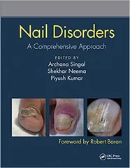 Nail Disorders A Comprehensive Approach 1st edition Archana Singal