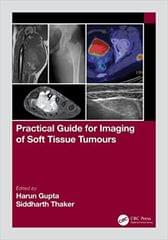 Practical Guide For Imaging Of Soft Tissue Tumours 1st edition Harun Gupta