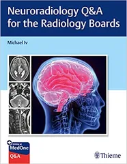 Neuroradiology Q&A for the Radiology Boards 1st Edition 2023 By Michael Iv