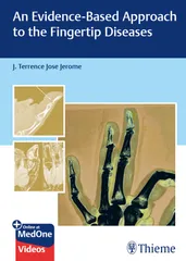 An Evidence-Based Approach To The Fingertip Diseases 1st Edition 2023 By J Terrence Jose Jerome�