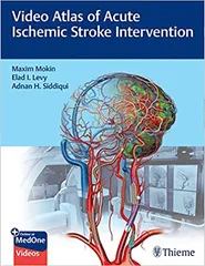 Video Atlas of Acute Ischemic Stroke Intervention 1st Edition 2022 By Maxim Mokin
