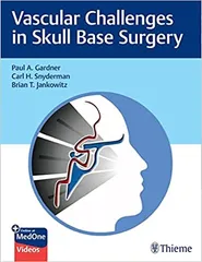 Vascular Challenges in Skull Base Surgery 1st Edition 2022 By Paul A Gardner