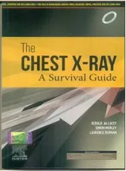 The Chest X-Ray A Survival Guide 1st Edition 2023 By Gerald de Lacey