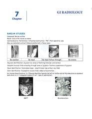 Radiology Cerebellum Notes