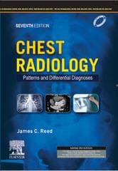 Chest Radiology Patterns and Differential Diagnoses 7th South Asia Edition 2023 By James Reed
