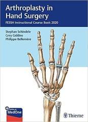 Arthroplasty in Hand Surgery FESSH Instructional Course Book 2020 By Stephan Schindele