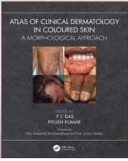 Atlas Of Clinical Dermatology In Coloured Skin A Morphological Approach 2024 By PC Das