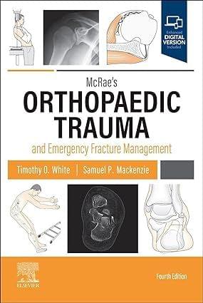 Mcraes Orthopaedic Trauma And Emergency Fracture Management With Access Code 4th Edition 2023 By White T O