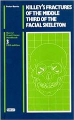 Fractures of the Middle Third of the Facial Skeleton 3rd Indian Edition By Peter Banks