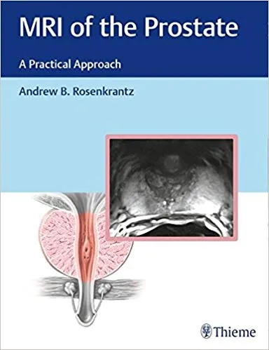 MRI of the Prostate: A Practical Approach 2016 By Andrew B. Rosenkrantz