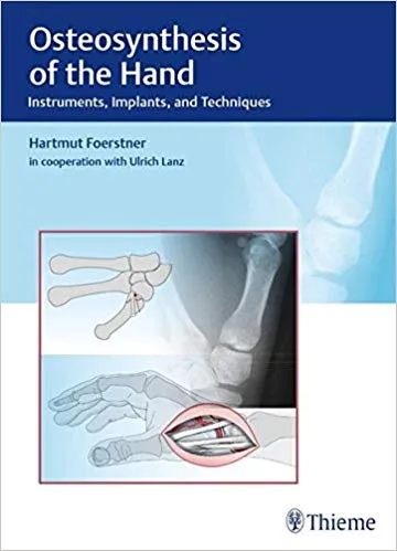 Osteosynthesis of the Hand 1st Edition 2016 By F�_rstner