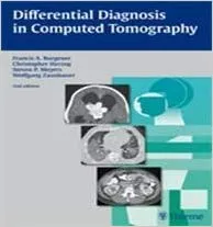 Differential Diagnosis in Computed Tomography By Francis A. Burgener