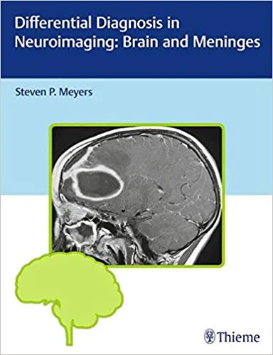 Differential Diagnosis in Neuroimaging 1st Edition 2016 By Steven Meyers