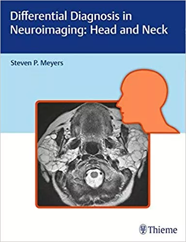 Differential Diagnosis in Neuroimaging 2016 By Steven Meyers