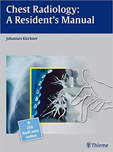 Chest Radiology: A Resident's Manual 2011 By Johannes Kirchner