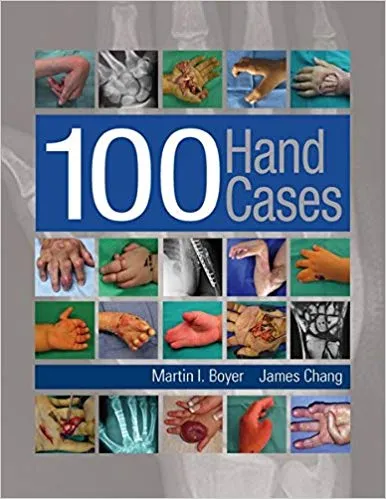 100 Hand Cases 1st Edition 2016 By Boyer