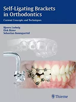 Self-ligating Brackets in Orthodontics 1st Edition 2012 By Bjoern Ludwig