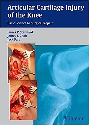 Articular Cartilage Injury of the Knee 2013 By James P. Stannard