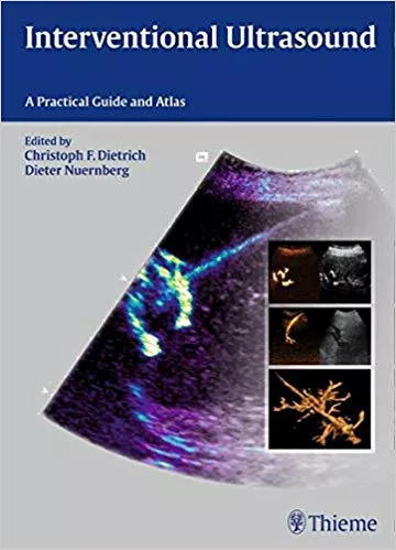 Interventional Ultrasound 1st Edition 2014 By Christoph F. Dietrich