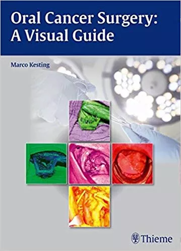 Oral Cancer Surgery: A Visual Guide 1st Edition By Marco R. Kesting