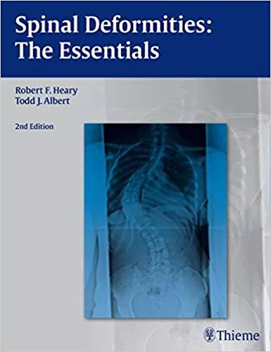 Spinal Deformities: The Essentials 2014 By Robert F. Heary