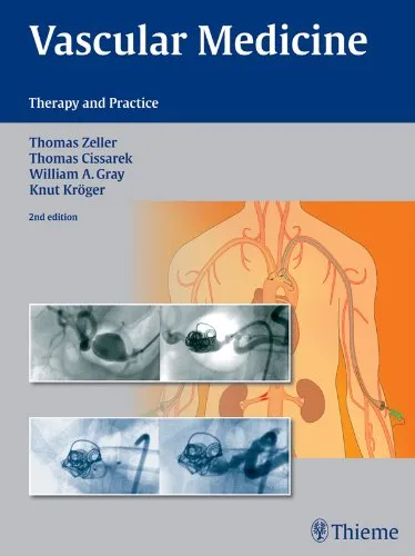 Vascular Medicine: Therapy and Practice 2nd Edition 2014 By Thomas Zeller
