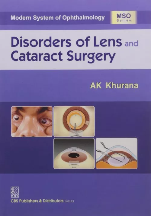 Disorders of Lens an Cataract Surgery 2018 by Khurana
