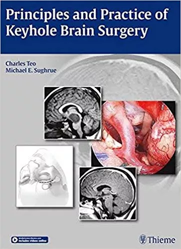 Principles and Practice of Keyhole Brain Surgery 1st Edition 2015 By Teo