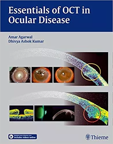 Essentials of OCT in Ocular Disease 2015 By Amar Agarwal