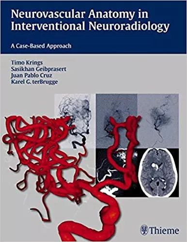 Neurovascular Anatomy in Interventional Neuroradiology 2015 By Timo Krings