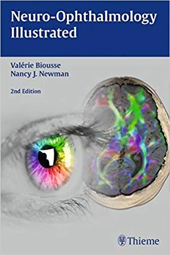 Neuro-Ophthalmology Illustrated By Valerie Biousse By Valerie Biousse