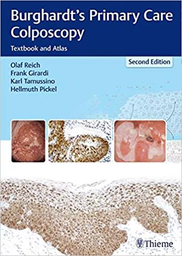 Burghardt's Primary Care Colposcopy 2nd Edition 2017 By Olaf Reich