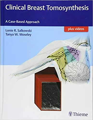 Clinical Breast Tomosynthesis 1st Edition 2017 By Lonie R. Salkowski