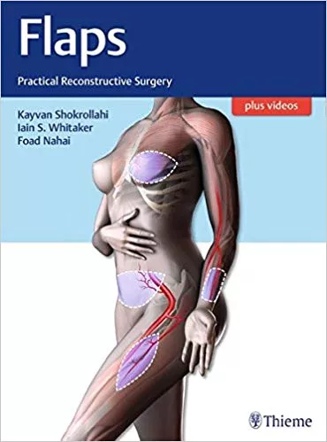 Flaps: Practical Reconstructive Surgery 2017 By  Kayvan Shokrollahi