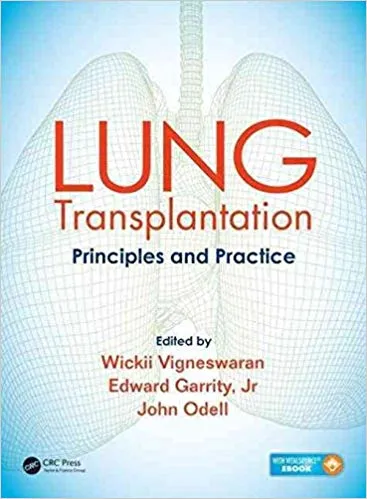 Lung Transplantation Principles And Practice (Pb 2016) By Wickii Vigneswaran
