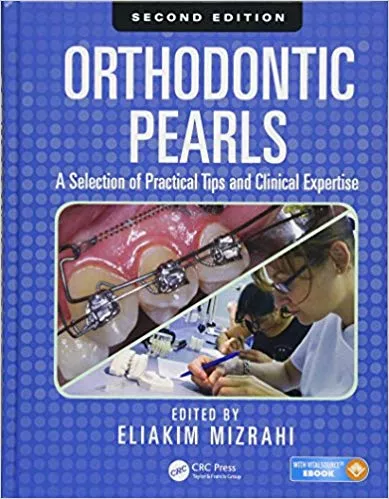 Orthodontic Pearls: A Selection of Practical Tips and Clinical Expertise, Second Edition 2015 By  Eliakim Mizrahi