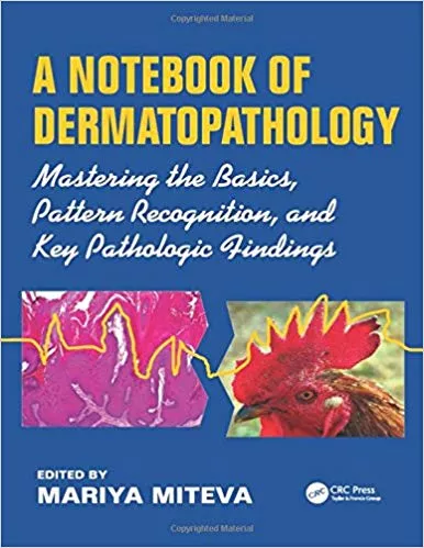 A Notebook of Dermatopathology: Mastering the Basics, Pattern Recognition, and Key Pathologic Findings By Mariya Miteva
