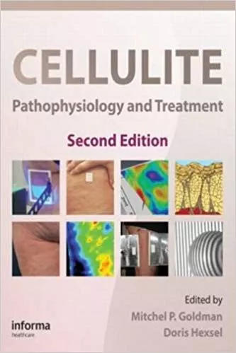 Cellulite: Pathophysiology and Treatment 2nd Edition 2010 By Mitchel P. Goldman