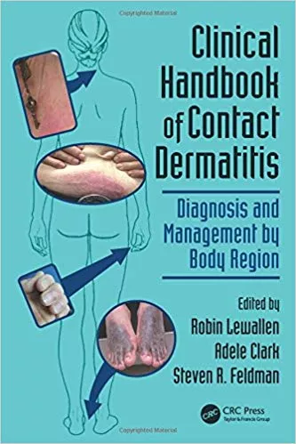 Clinical Handbook of Contact Dermatitis 2014 By Robin Lewallen