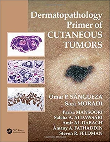 Dermatopathology Primer of Cutaneous Tumors 2015 By Omar P. Sangueza