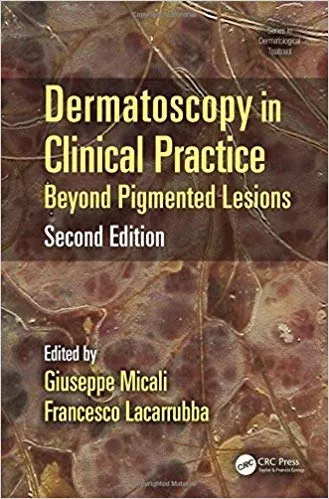 Dermatoscopy in Clinical Practice: Beyond Pigmented Lesions Second Edition 2016 By Giuseppe Micali