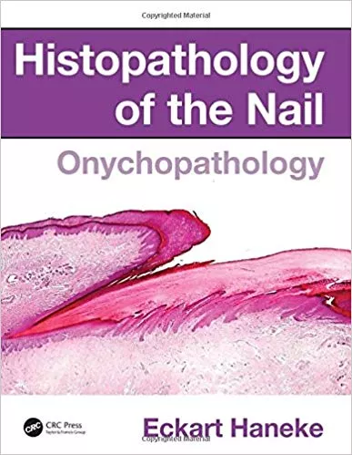 Histopathology of the Nail: Onychopathology 2017 By Eckart Haneke